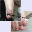 엄지맥주 네이버블로그