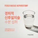 PCN 티스토리