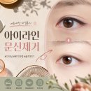미인유성형외과의원 | 아이라인 문신 제거 후기｜14시간 금식했는데 시술을 못 받을 뻔한 이유 (+입술 문신 제거 포기한 이유)