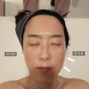 (주)세종통운 | 창원 작은얼굴 윤곽관리 끌리메 다녀온 후기