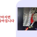 오클라호마자연주의치과 네이버블로그
