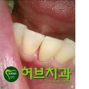 허브치과기공소 네이버블로그
