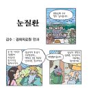 눈질환 - 안과 진경현교수 이미지