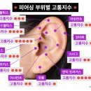 저 오늘 피어싱 스너그 뚫었는데 죽을뻔헸어여 짘쨔ㅠㅠ귀사진주의 이미지