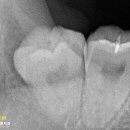 송탄바른치과의원 이미지