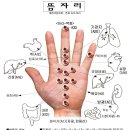뜸