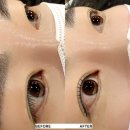 라온초등학교 | 울산 무거동 속눈썹펌 잘하는 곳 ‘라온뷰티’ 노글루수분펌 후기
