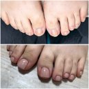 파고드는 발톱 때문에 아크릴 연장 받은 당산 네일샵 네일포시즌 풋풋한 리쌤 당산점 후기