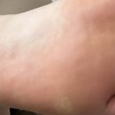 메디레스큐 이미지