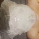 스파아루카 ▶ 송도 피부관리실 : 여드름케어 재생관리