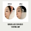영등포기계상가 | [영등포시장 피부관리] 이안에스떼 1:1맞춤케어 솔직후기