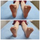 인천 미추홀구 체형관리 <엘림통증체형관리센터> 교정 후기