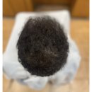 함양미장원 | 두피시술을 받아도 휑할때 르네시떼미용실에서 탈모교정펌과 피부에묻지않는블랙염색두피케어로 헤어재탄생