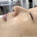SY 메디칼 | [광교피부샵] 아주대 피부관리 샵으로 유명한 SY뷰티랩에서 피부관리 받고 온 후기