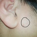 김동수치과의원 | 턱관절 통증 치료 후기(비용)