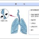 기관지 천식 치유원리 및 치유 약선(약초)차 안내 이미지