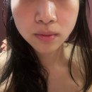 청담에스테틱 강남신부관리 뷰티블르바드 등얼굴V라인 관리