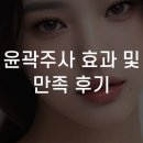만족 | 윤곽주사 효과 및 만족 후기