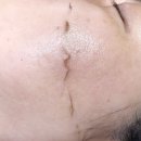 둔산동 스킨플래닝 X 도자기 피부 만들어주는 더비채라이콘