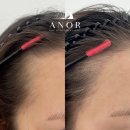 차밍헤어 이미지