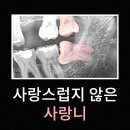 증산역치과, 사랑니 발치가 필요한 경우는? 이미지