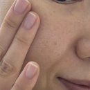 에스블랙 | [광고][블프세일 에슬] 블랙프라이데이 지름템 후기✨ 2주 만에 기미가 사라졌다? 에슬 알비타치온 기미...