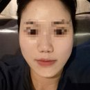 달리아에스테틱(신촌점) | [이대역] 신촌피부관리 달리아에스테틱 신촌점 맞춤피부관리 후기