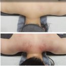 유비르에스테틱 | 청주산전관리잘하는 곳인, 유비르에스테틱 후기