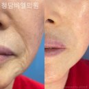 청담비엘의원 이미지