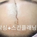 윤피부토탈관리