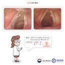 쉼; 이미지