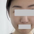 리뉴 이미지