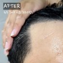 도트바버샵(DOT Barbershop) | 블로그 이름을 걸고 자신있게 추천하는 도트스칼프 마지막 후기