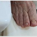 페디럭스네일 내성발톱무좀발톱발각질 관리가 가능한 강남 네일샵 이용 후기!