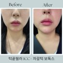 톤즈의원 동탄점 네이버블로그