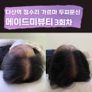 메이드미뷰티스튜디오 | 다산동 두피문신 추천 메이드미 뷰티스튜디오 30대 남성탈모 SMP 3회차 후기