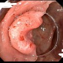 속편한장내과의원 이미지