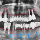 연세이로운치과의원 이미지