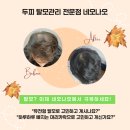 네오나오영등포 | 정수리가 허전해...? 거울 속 'M자 이마'에 충격! 혹시 나도 남성호르몬성 탈모 초기 증상?