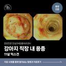 강내동물병원 | 구의동물병원 혈변을 보이던 11살 노령견의 직장 내 용종 치료 케이스