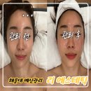 세종월드프라자 | 장산역 에스테틱, 리 에스테틱 내돈내산 후기