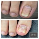 엠블케어 이미지