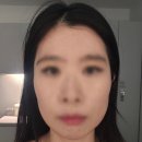 포항시북구47 | 작은 얼굴 관리 후기 달리아 에스테틱 포항점