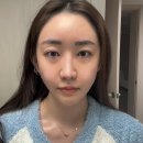 끌리베 | “30대 되니까 광이 사라졌다… 끌리베 아가 에센스 & 레티놀 패드 솔직 후기”
