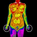 로하스한의원 이미지