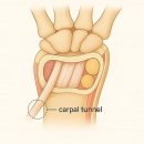 바로튼튼365의원 이미지