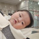 정읍사랑병원 | 6개월 아기 손 화상 지역 화상병원에서 치료 후기