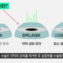 커스텀아이즈 이미지