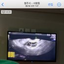 (주)엠에스 | [임심준비#11] 엠에스여성의원 시험관 난자채취 후기 (매우 아픔) - 근육주사, 돌주사