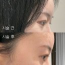[원흥 속눈썹] 원흥 속눈썹 뮤뮤 • 노글루 클리닉 속눈썹펌 후기